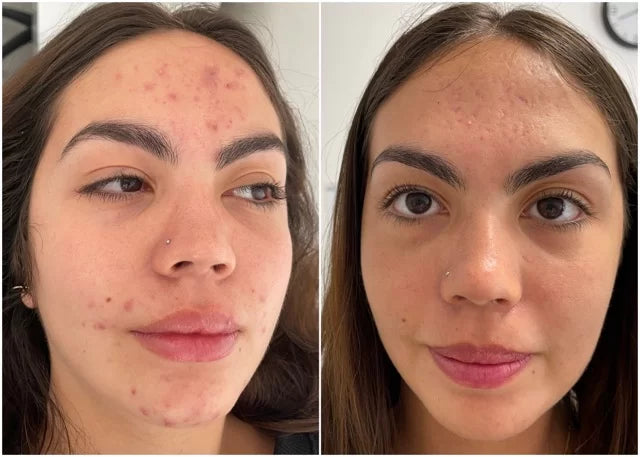 Verónica, 33 años