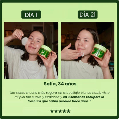 Parches para Ojos Antimanchas con 5% de Centella Asiática – Pack de 50