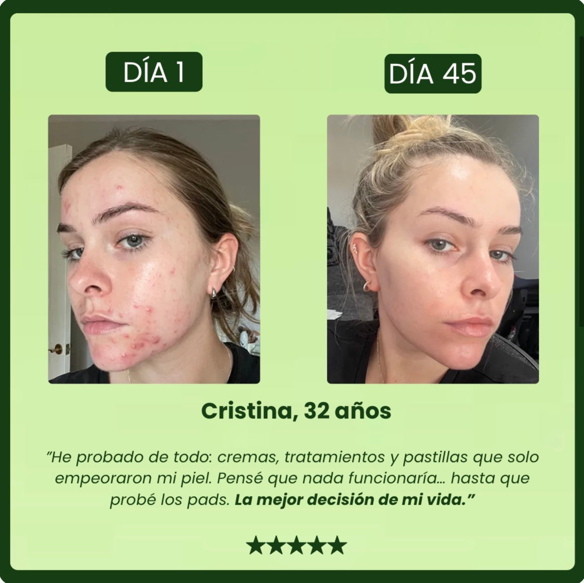 Parches para Ojos Antimanchas con 5% de Centella Asiática – Pack de 50