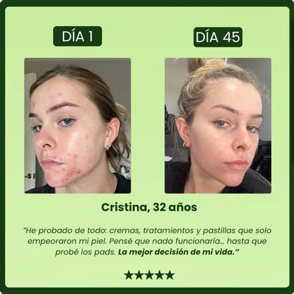 Parches para Ojos Antimanchas con 5% de Centella Asiática – Pack de 50